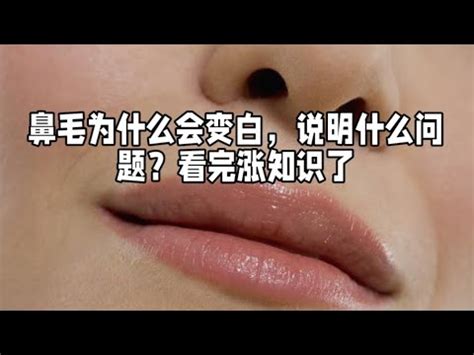 白色毛|鼻毛为什么会变白？真的是长寿的征兆吗？医生告诉你真相